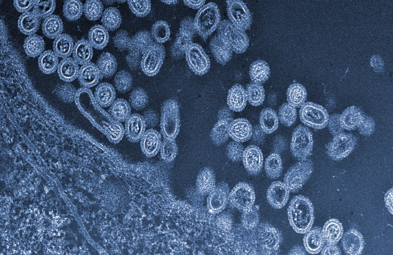 Illustration for article titled Psychedelic Images of Terrifying Viruses